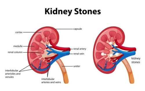 Best Nephrologist in Agra